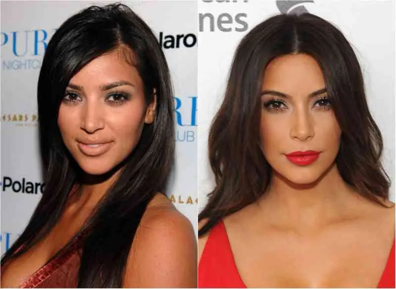 20 celebs who make us want to get plastic surgery 8