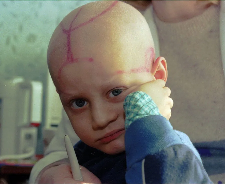 five year old alec zhloba who suffers from leukemia is held by his doctor in the childrens cancer ward of the gomel regional hospital belarus his head has tracks from medical procedures march 19 1996