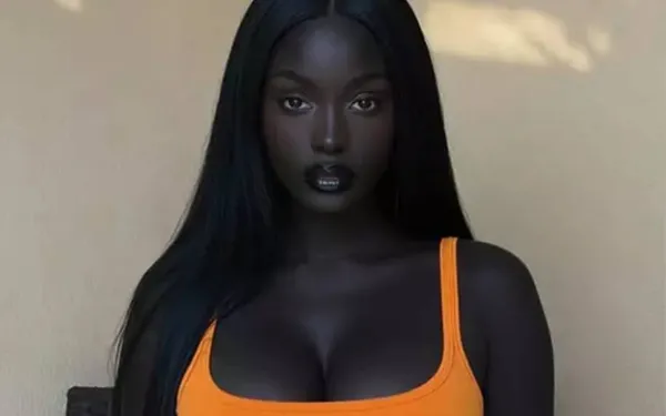 Verontrustende waarheid achter influencer die wordt bestempeld als ‘de knapste vrouw ter wereld’