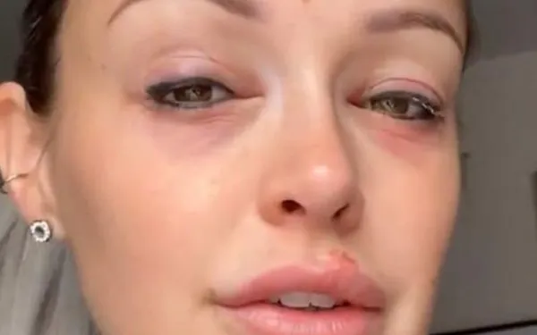 pommelineINSTAGRAM 1 1