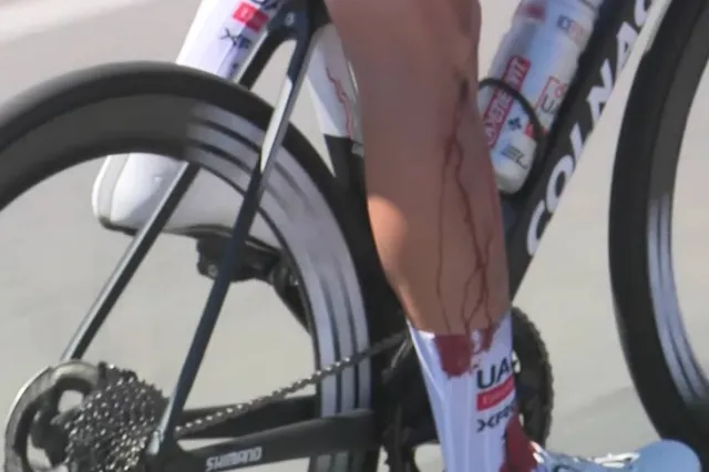 Medical Report and withdrawals Tour Down Under 2025 - Update stage 4 - Jay Vine crashes once again