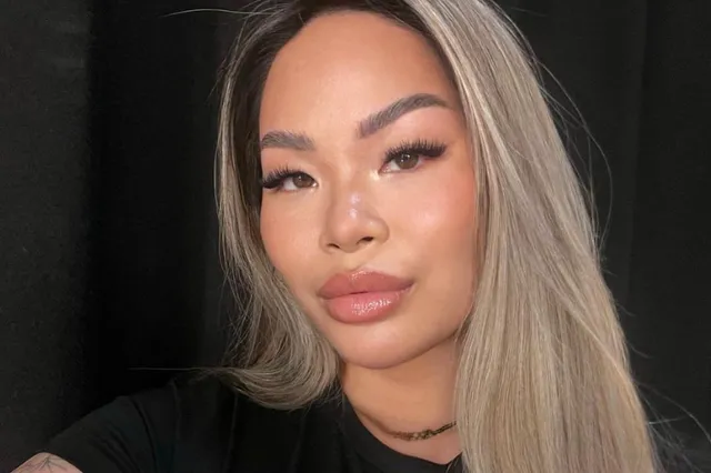 Bye lipfillers: Lena onthult haar transformatie na het verwijderen van fillers