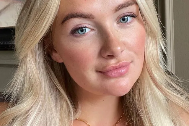 Before and after: Maxime Meiland deelt foto van cosmetische ingreep aan onderkin