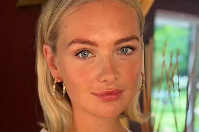 Maxime Meiland ondergaat een mysterieuze cosmetische ingreep