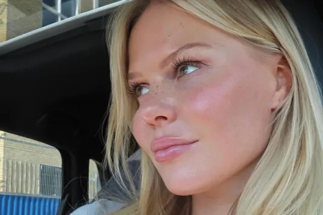 Vocht in je gezicht? Probeer de Koreaanse beautyhack: twee elastiekjes om je oren