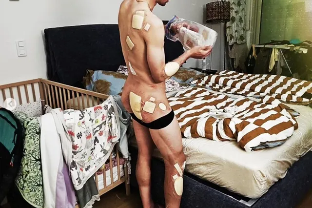 Primoz Roglic zeigt seine schweren Verletzungen auf einem Foto aus dem Schlafzimmer