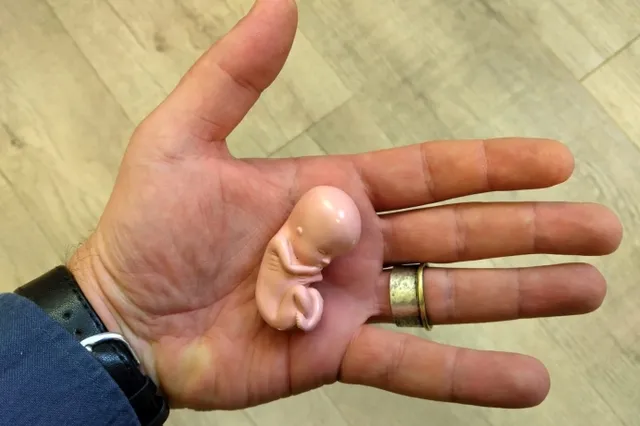 -Cultuur onder Vuur- Geweten wordt aangesproken: pro-abortus politici vallen over onze pop van ongeboren kind