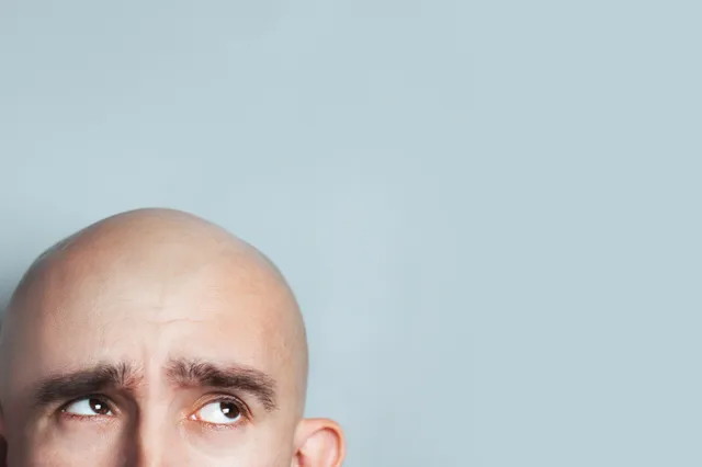 Waarom worden mannen kaal? En kun je er  iets aan doen?