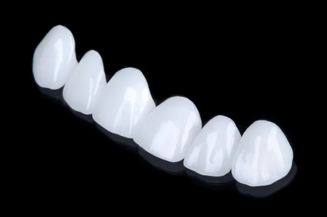 Wat je moet eten voor witte tanden