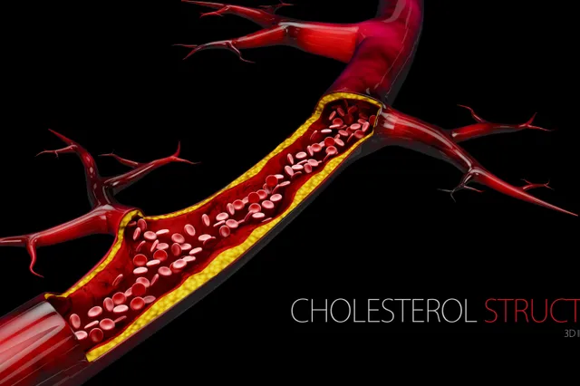 'Cholesterol wordt pas gevaarlijk als er te veel van op de verkeerde plek terechtkomt'