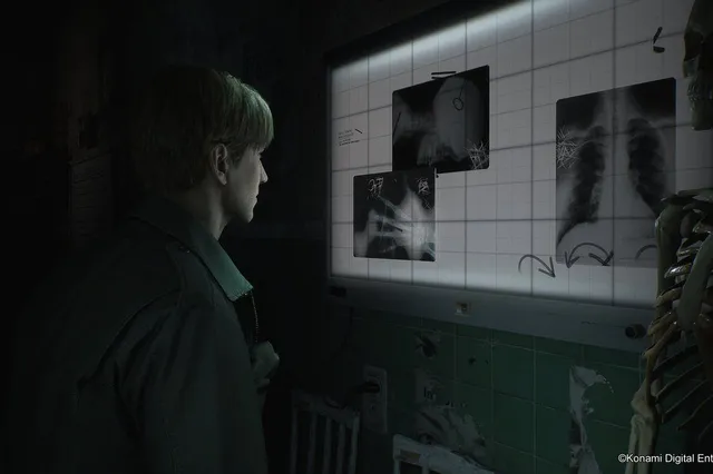 Nieuwe Silent Hill in de maak? Bloober Team werkt weer samen met Konami