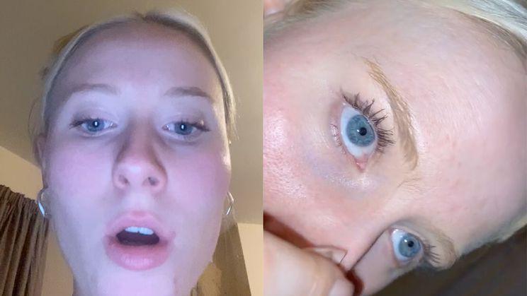 Emily heeft één echt extreem lange wenkbrauwhaar