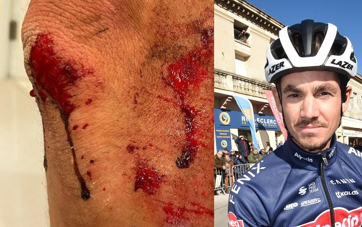 Richardson op brute wijze aangevallen en beroofd: 'Ze trokken een 15 inch machete'