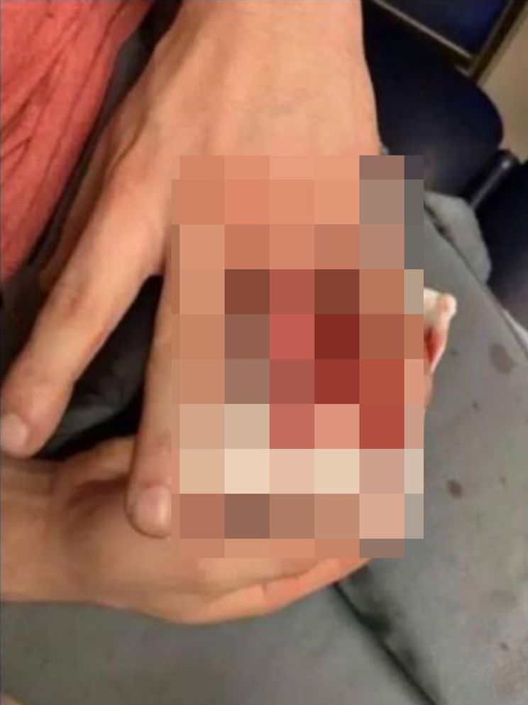 Grote ravage na rellen in Rotterdam: Politie vindt een vinger