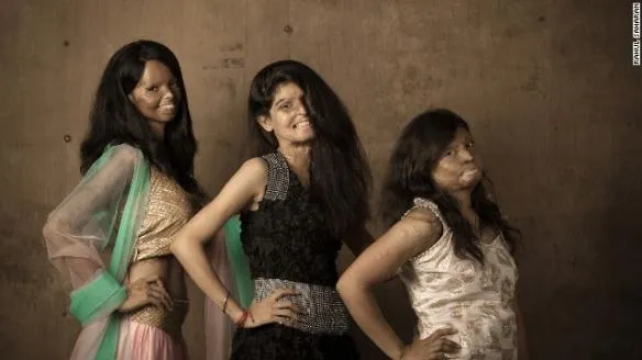 140820115241 india acid model 7 horizontal gallery 584x328