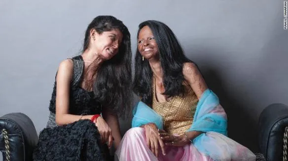 140820115316 india acid model 9 horizontal gallery 584x328
