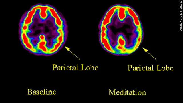 t1largmeditationscancourtesy
