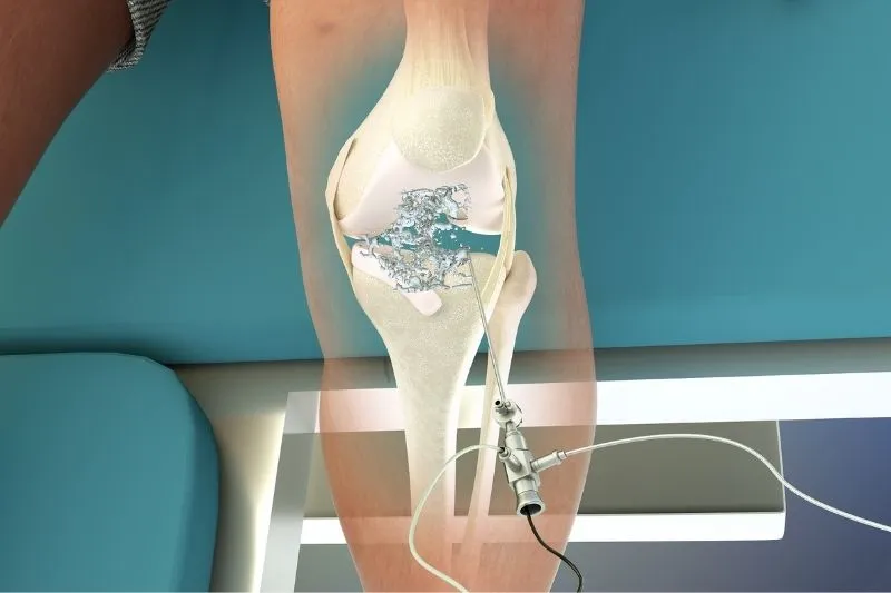 ontwerp zonder titel 6