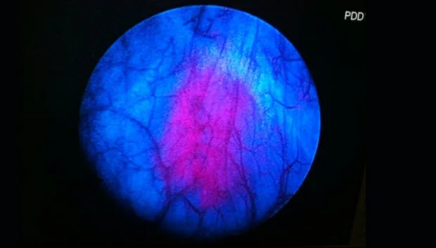 sp4uyp0fpc326mfenr48rq0sl blaas blauw licht