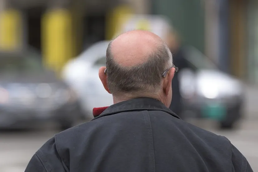 bald 742823 1280 e1443712425822