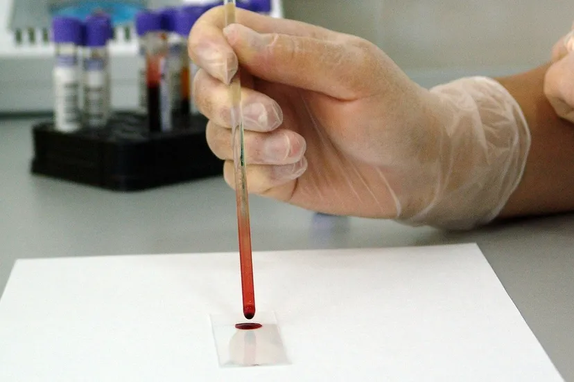 blood 17305 1280 e1433543245472