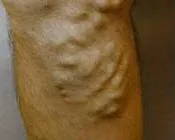 m223qm9a2a0tke2khreay505l 203026