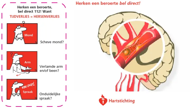 w2x4atgecd3rklzsr5nqrg3wo herken een beroert
