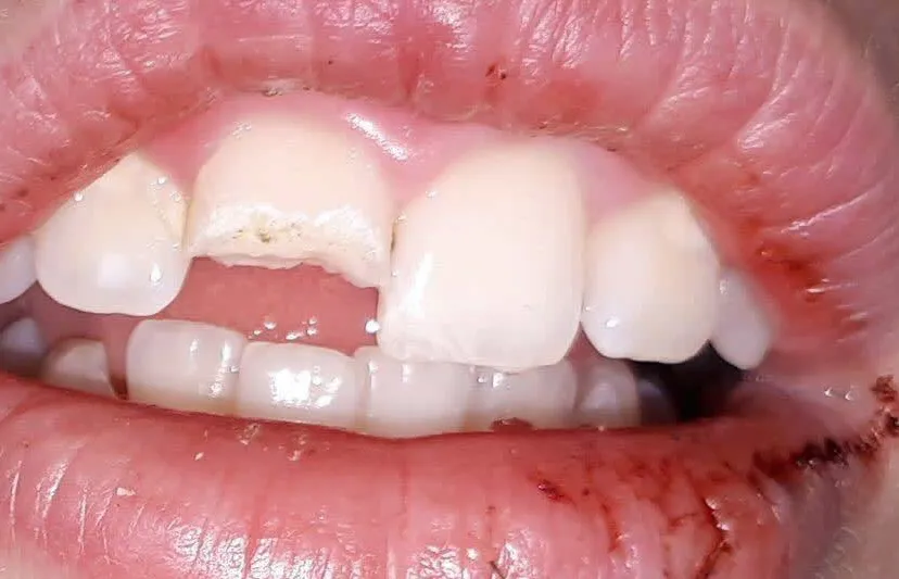 26239217 1557711287645158 2842378378500045514 n