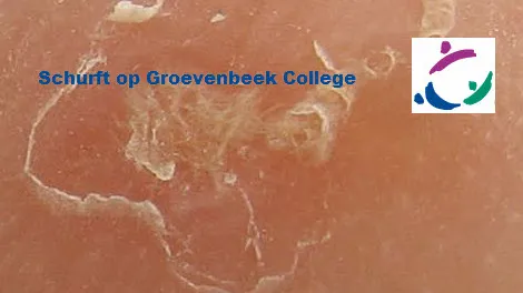 uvc40lp4y181rxtz1k2rgkbqo 29en schurft