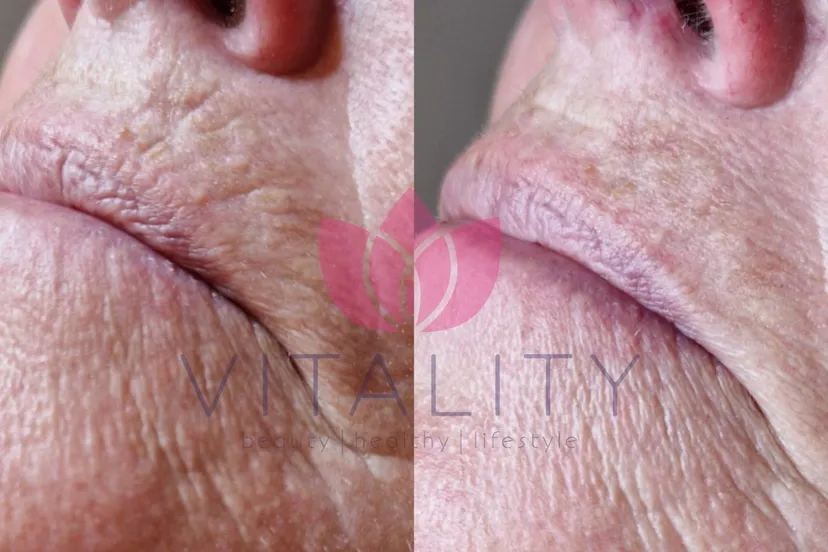 ontwerp zonder titel 1