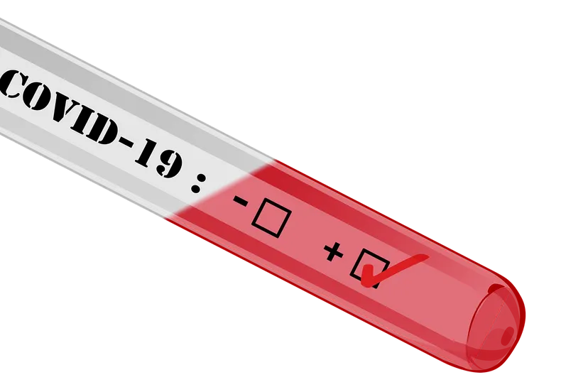 covid 19 4908690 1280 coronavirus temperatuur