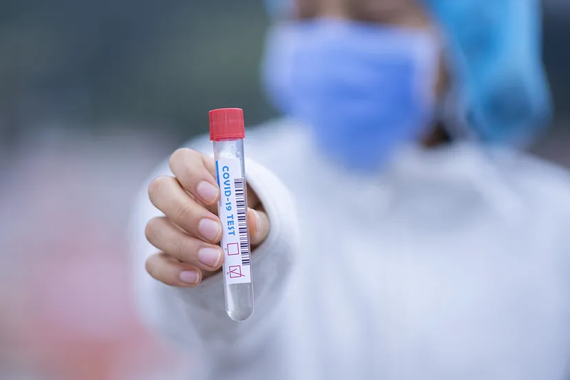 test tube 5065424 1920