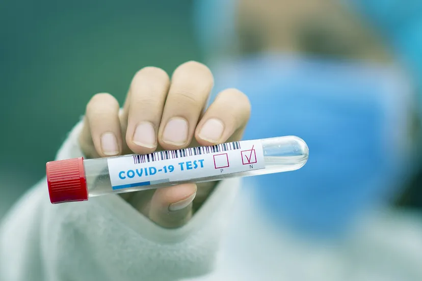 test tube 5065425 1920