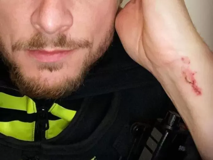 wijkagent patrick van geel in pols gebeten1