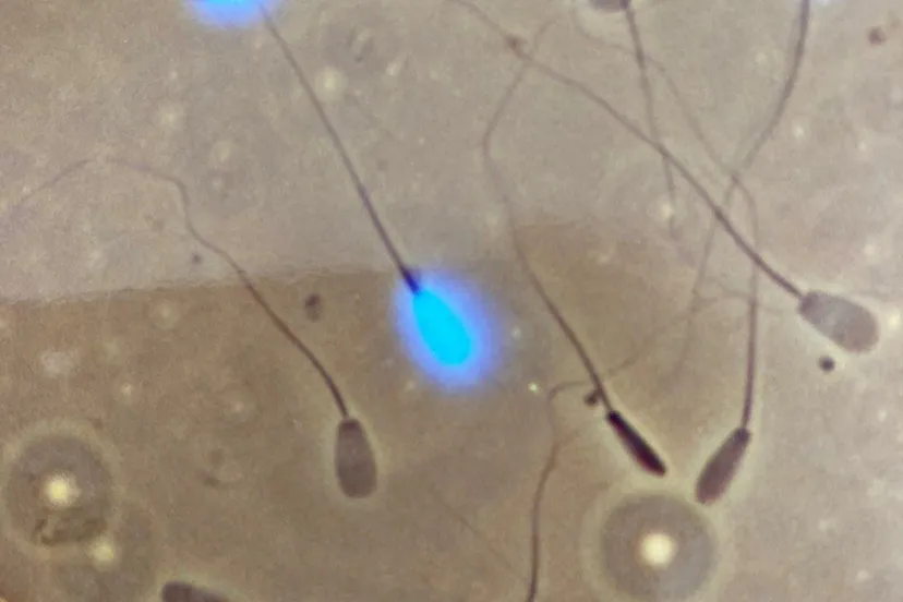 vruchtbaarheidlingewaardnatuurlijk