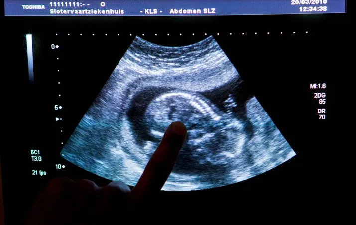 babys overleden bij onderzoek umc amsterdam