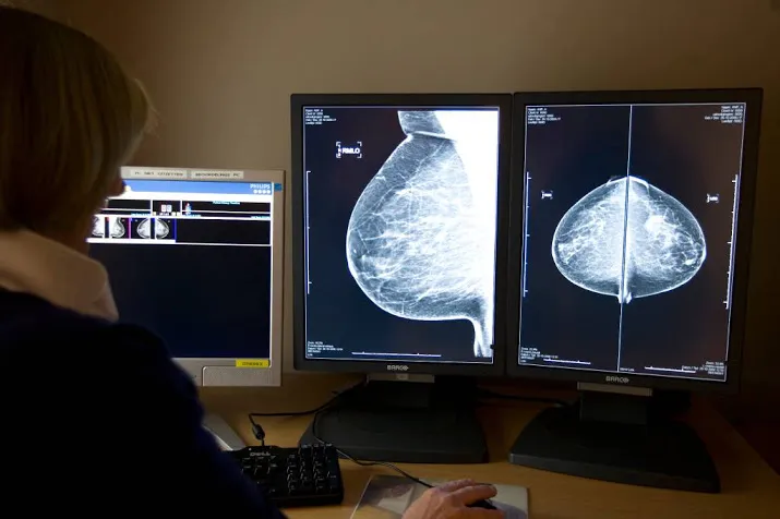 weinig info kankerpatient over lange termijn