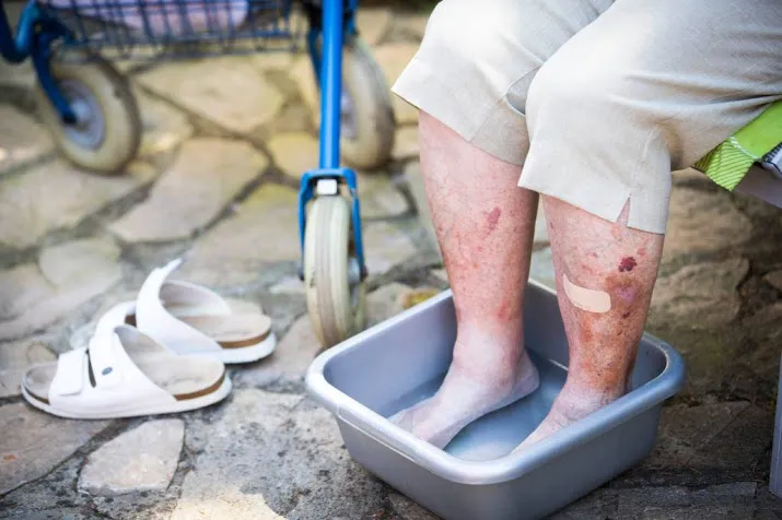 zorg voor kwetsbare ouderen tijdens hitte