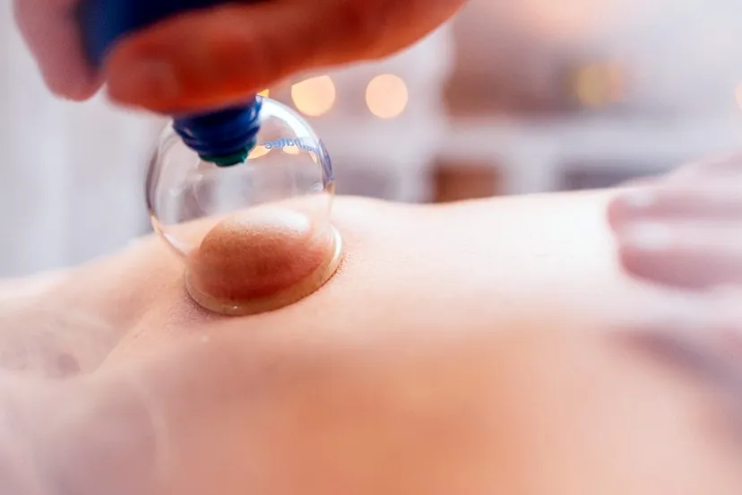 2016 04 25 cuppung therapie uit de drukte