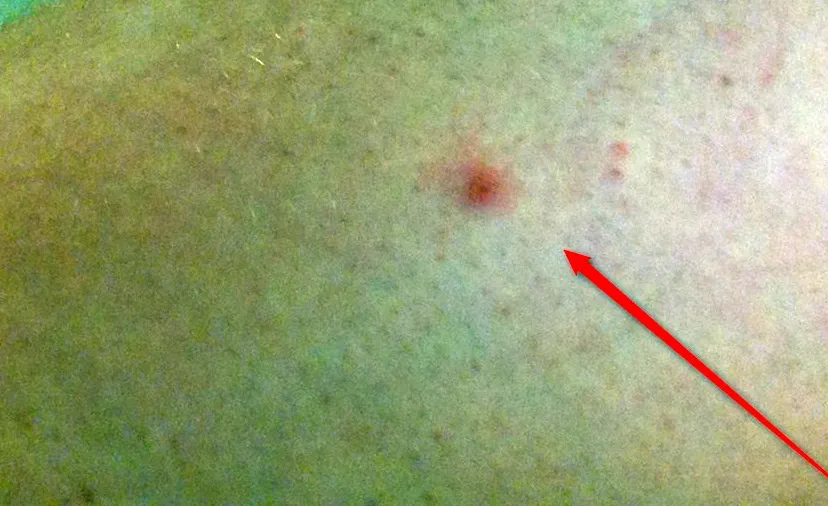 2016 07 01 tekenbeet