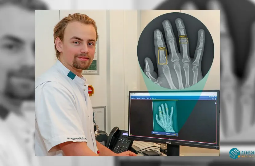 2024 01 09 botbreuken