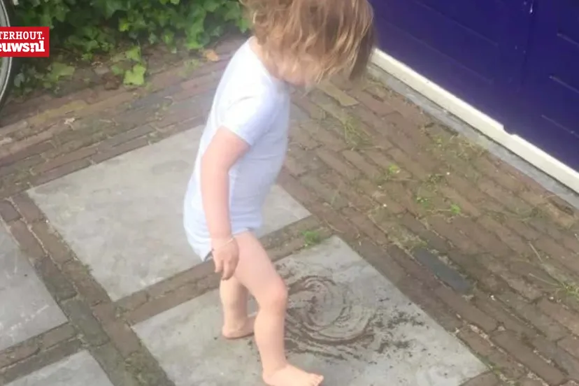 brandwondenstichting