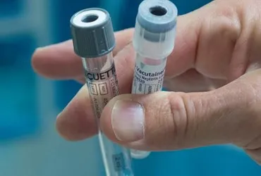 bloedbuizen horizontaal