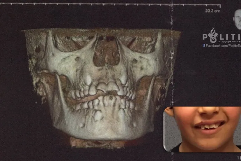 politie ede jongetje 10 jaar