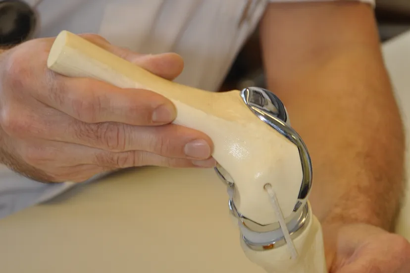 informatieavond artrose