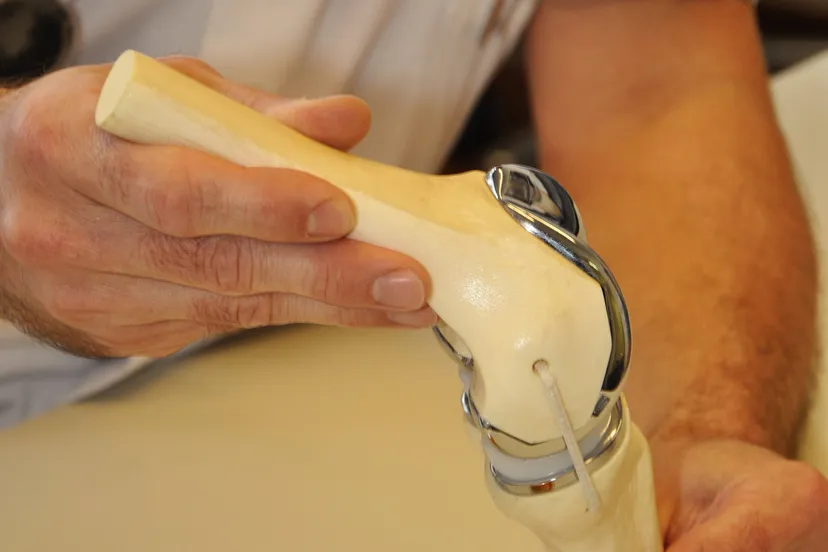 informatieavond artrose