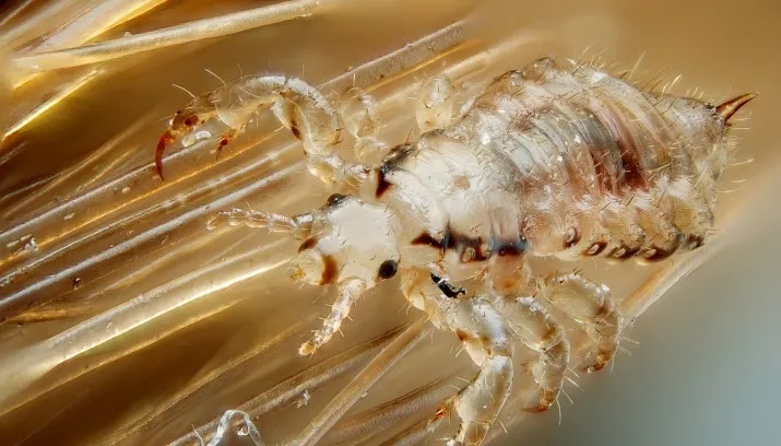 hoofdluis gilles san martin cc by sa 20 715x408