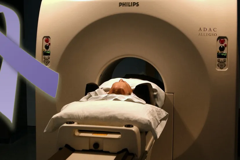 alvleesklier kanker awareness maand