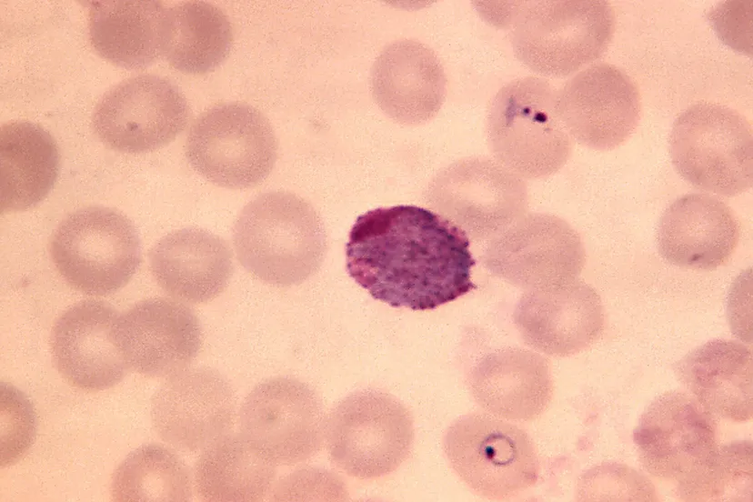 baarmoederhalsuitstrijkje