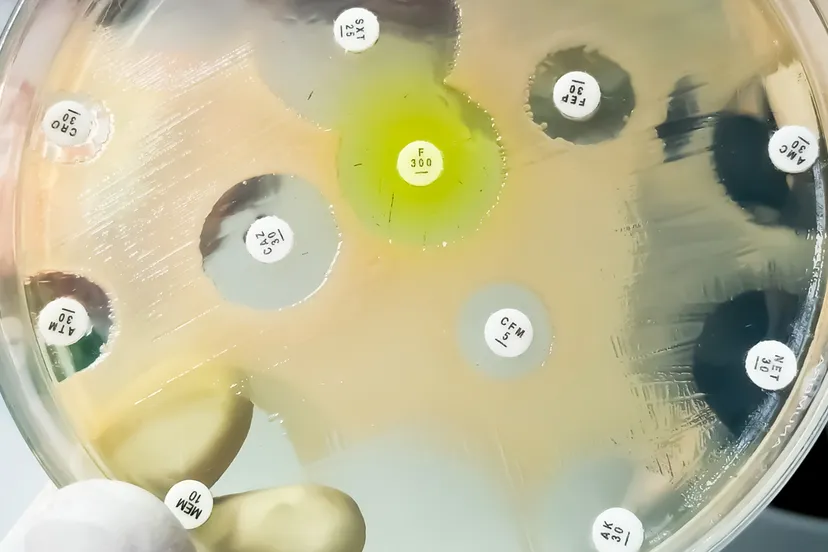 bacterieel onderzoek